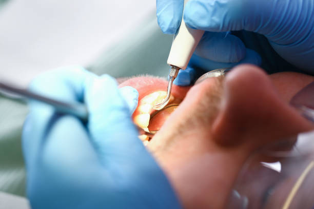 Best Broken or Chipped Tooth Repair in Ronceverte, WV